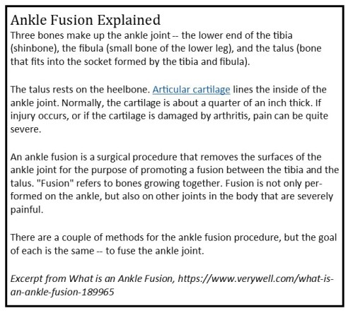 what-is-an-ankle-fusion